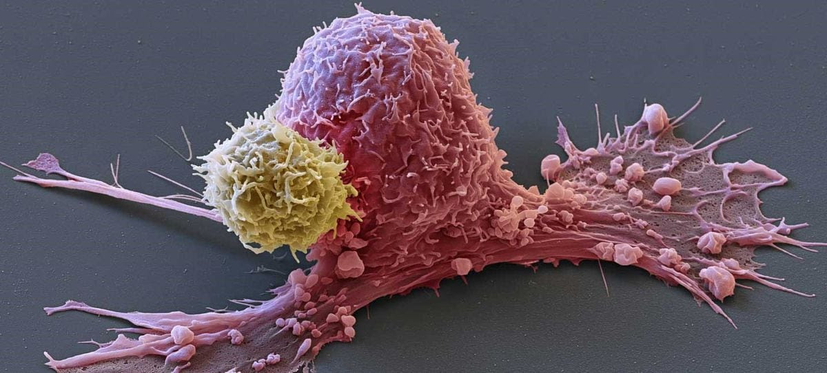 La EMA pide información a EE UU sobre los casos de cáncer causados por las terapias innovadoras CAR-T