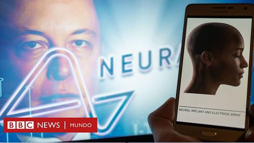 Elon Musk anuncia el primer implante de un chip de su compañía Neuralink en el cerebro de un humano